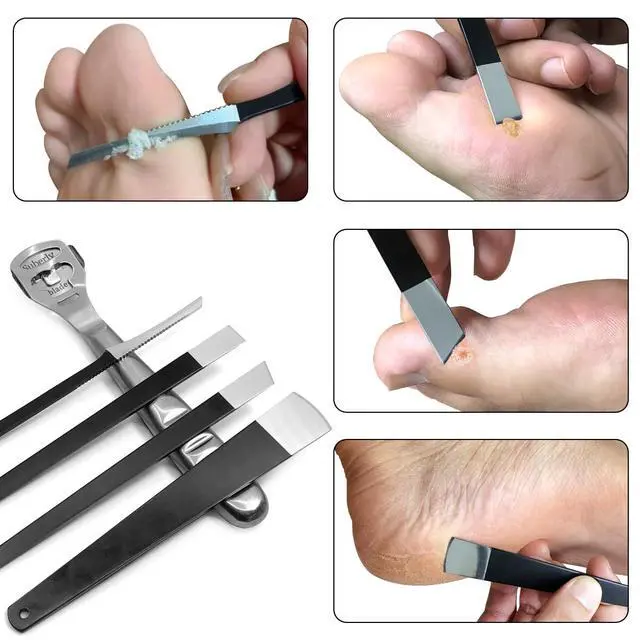 Alt view image 5 of 6 - 36 Pcs Callus Shaver for Feet Set, (1Stainless Foot File &1 Foot File Heads & 30 Replacement Slices Blades & 4 Pedicure Knife), Professional Callus Remover for Feet Tools for Wet and Dry Feet