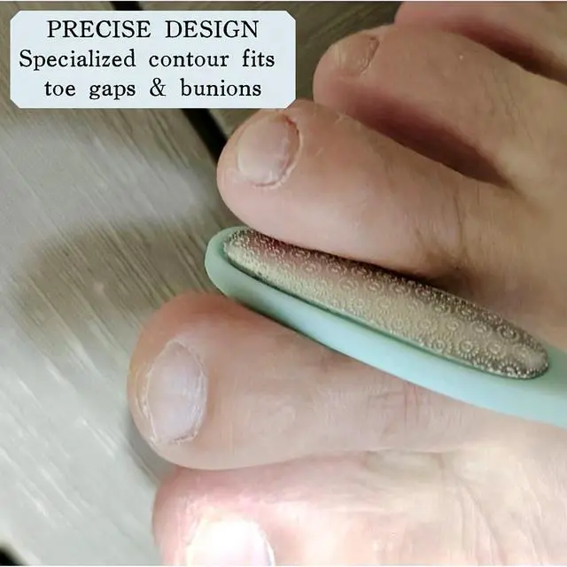 Alt view image 2 of 7 - Precision Callus Remover & Bunion Scrubber for Toe Gaps, Hard Skin, and Corns Mini Foot File Exfoliator with Compact Design for Pedicures and Sensitive Areas