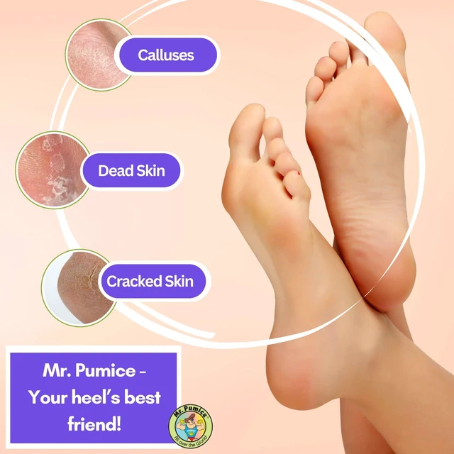 Alt view image 5 of 7 - Ultimate PUMI Bar 2-in-1 Dual Grit (Medium + Coarse) Callus Remover, Pedicure Stone & Ped File Scrubber for Smooth Feet and Heels (4 Pack)
