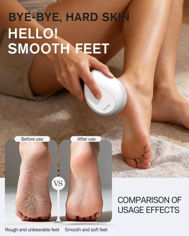 Alt view image 3 of 7 - Glass Pumice Stone, Foot File Callus Remover for Feet, Professional Foot Scrubber for Dead Skin & Cracked Heels Premium Pedicure Tools with Anti-Slip Handle and Protective Cover - White