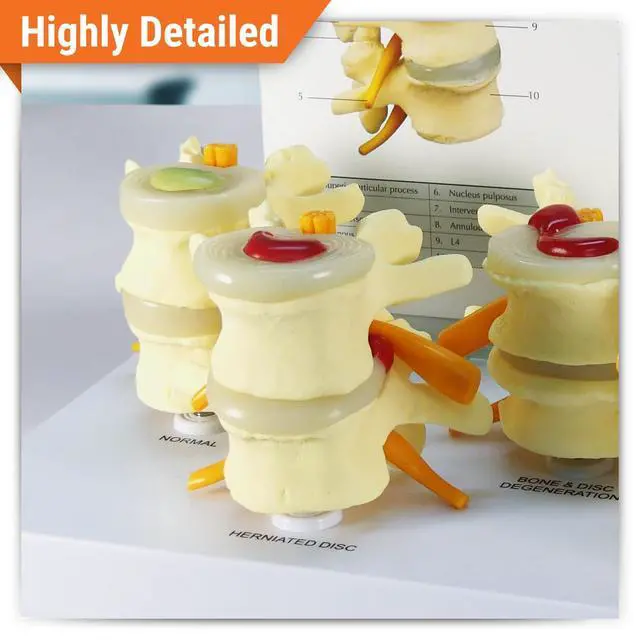 Alt view image 2 of 6 - 4-Stage Vertebrae ModelSpine Model | Human Body and Anatomy Replica for Physiology Education, Anatomical Model for Doctor's Office, Medical Learning Resources