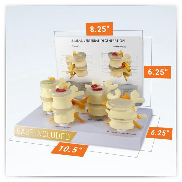 Alt view image 6 of 6 - 4-Stage Vertebrae ModelSpine Model | Human Body and Anatomy Replica for Physiology Education, Anatomical Model for Doctor's Office, Medical Learning Resources