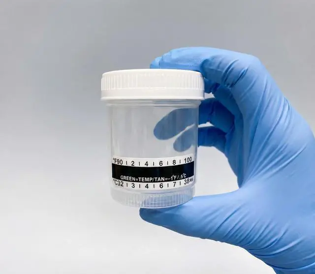 Alt view image 3 of 5 - Sterile Urine Specimen Cups with Lids | 300 Pack | 90 ML Individually Wrapped Urine Collection, Temperature Strip, Graduation Scale