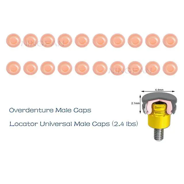 Alt view image 2 of 6 - Overdenture Retention Cap Locater Replacement Male Inserts Caps Standard Pink 2.4lbs Xtra-Light (20Pcs Overdenture Male Inserts Caps Pink 2.4lbs)