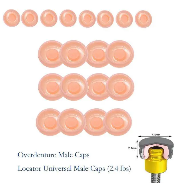 Alt view image 4 of 6 - Overdenture Retention Cap Locater Replacement Male Inserts Caps Standard Pink 2.4lbs Xtra-Light (20Pcs Overdenture Male Inserts Caps Pink 2.4lbs)