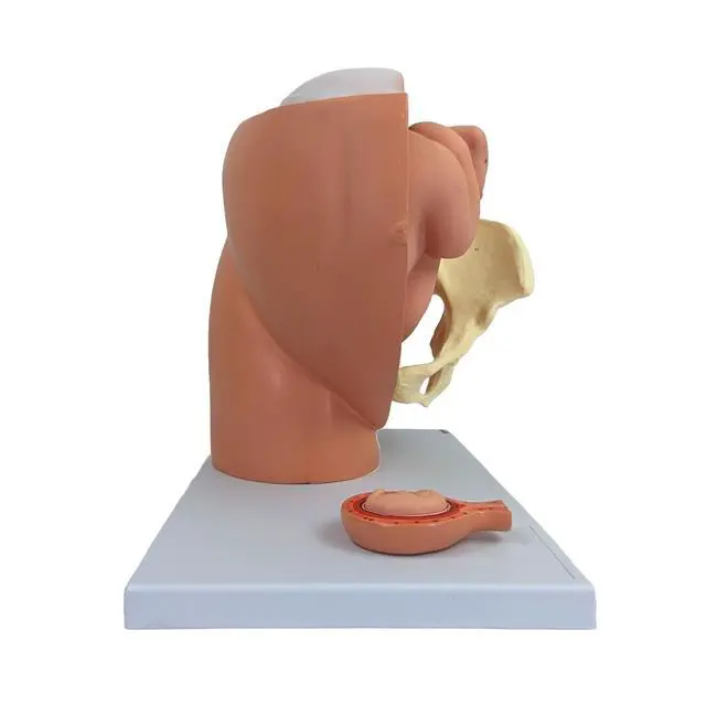 Alt view image 4 of 6 - Anatomy Model of Pregnancy Pelvis - Includes a Full-Term Removable Fetus Model, Anatomy of the Placenta and More Than 40 Anatomical Landmarks
