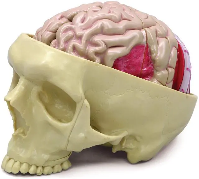 Main image of Brain Model Inside Partial Skull Afflicted by Pathologies | Human Body and Anatomy Replica for Physiology Education, Anatomical Model for Doctor's Office, Medical Learning Resources