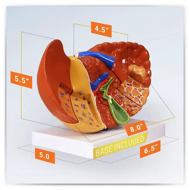 Alt view image 6 of 6 - Liver Model with Common Pathologies | Human Body and Anatomy Replica for Physiology Education, Anatomical Model for Doctor's Office, Medical Learning Resources