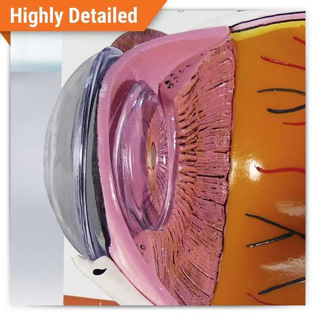 Alt view image 2 of 6 - Cataract Eye Model of an Eye with Cataract Conditions | Human Body and Anatomy Replica for Physiology Education, Anatomical Model for Doctor's Office, Medical Learning Resources
