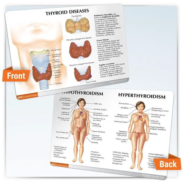 Alt view image 5 of 6 - Thyroid Model Set with Larynx and Thyroid | Human Body and Anatomy Replica for Physiology Education, Anatomical Model for Doctor's Office, Medical Learning Resources