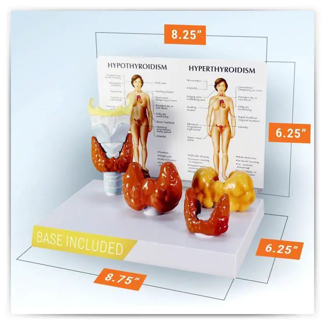 Alt view image 6 of 6 - Thyroid Model Set with Larynx and Thyroid | Human Body and Anatomy Replica for Physiology Education, Anatomical Model for Doctor's Office, Medical Learning Resources