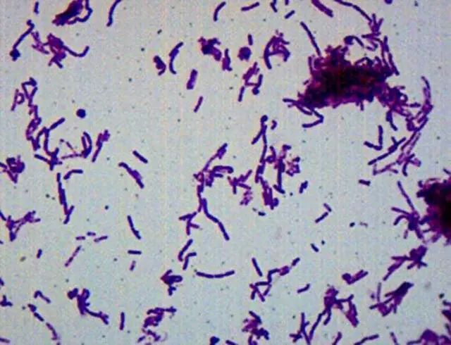 Main image of 25pk Bacillus Smear, Gram Negative Stain - Prepared Microscope Slides - 75 x 25mm - Classroom Pack, 25 Slides in Storage Case - Biology & Microscopy - Labs
