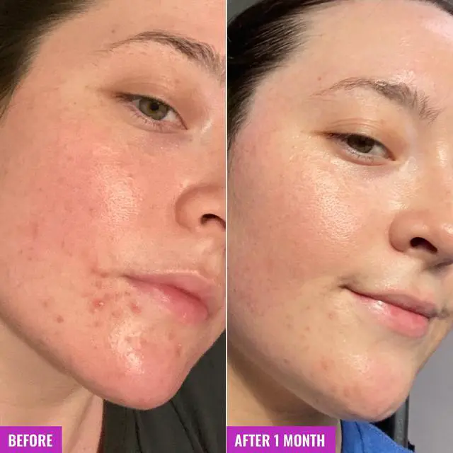 Alt view image 5 of 7 - Good Molecules Clarify and Cleanse Bar - Soap Free Bar with Salicylic Acid, BHA for Skin Tone Balancing and Cleansing - Body and Facial Cleanser, Skin Care for Face