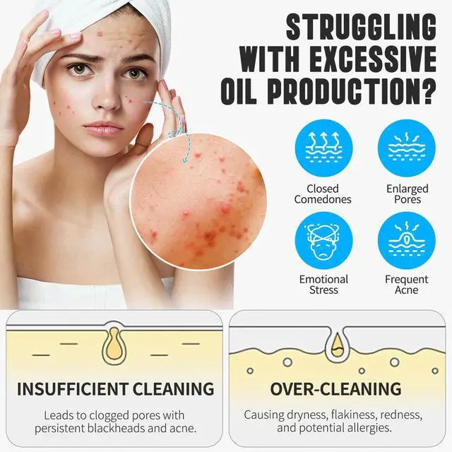Alt view image 6 of 7 - Turmeric Facial Cleanser,Urmeric Facial Foam Foaming Face Wash, Deep Cleaning Turmeric Foaming Cleanser for All Skin 150ML