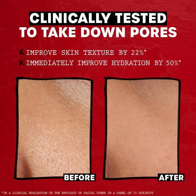 Alt view image 4 of 7 - Trial Size Alcohol Free Unscented Witch Hazel Facial Toner with Aloe Vera Formula- 3 oz