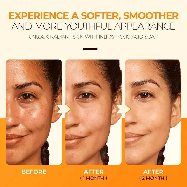 Alt view image 5 of 7 - Acid Turmeric Soap: Dark Spot Remover for Face Body - Skin Cleansing Bar for Women with Hyperpigmentation - Home Travel Use in Summer