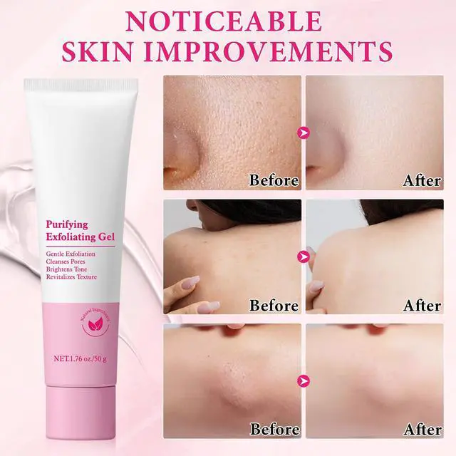 Alt view image 5 of 7 - Purifying Exfoliating Gel, 2 Pack Face Facial Exfoliator Cleanser, Gentle Face Scrub Exfoliating Gel Purifying for Facial & Body Deep Cleansing, Regulates Water & Oil Balance, Smoother & Softer