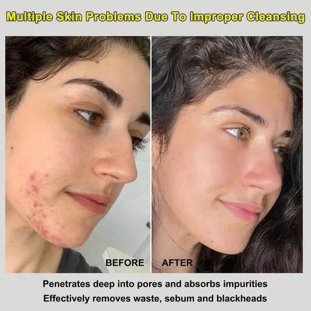 Alt view image 6 of 7 - Mud Mask, Relief Mud Mask for Face & Body, Deep Cleansing & Hydrating Clay Mask, Deep Pore Cleanser Oil Control Wash Off Body Mud