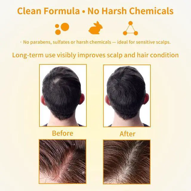 Alt view image 6 of 7 - 2 Pack Turmeric Hair Shampoo Bars, Ginger Soap for Growth Natural Turmeric Solid Bars for Hair Deep Cleansing