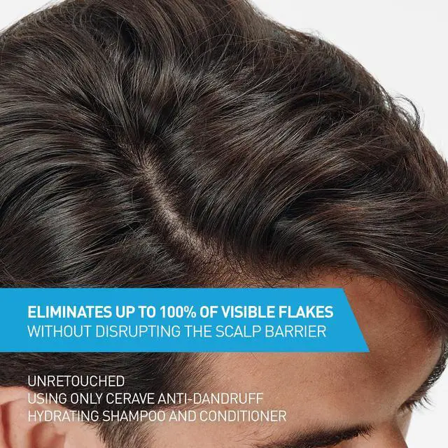 Alt view image 2 of 7 - Hydrating Anti Dandruff Conditioner, 0.5% Pyrithione Zinc Dandruff Treatment With Ceramides, Hyaluronic Acid & Niacinamide, Helps Eliminate Flakes & Reduce Itchy Scalp, Sulfate Free Conditioner