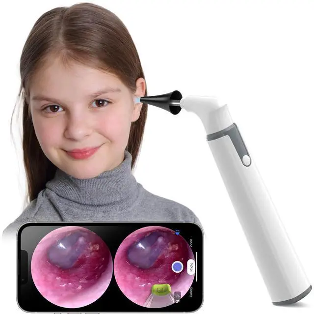 Main image of WiFi Otoscope, HD Otoscope Camera with Light, Ear Checker for Kids & Adults