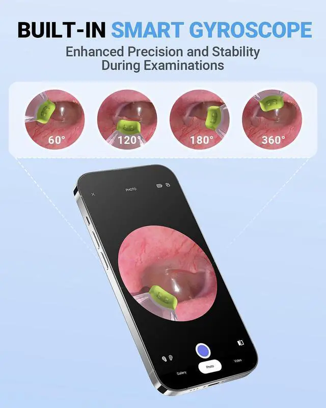 Alt view image 5 of 7 - WiFi Otoscope, HD Otoscope Camera with Light, Ear Checker for Kids & Adults