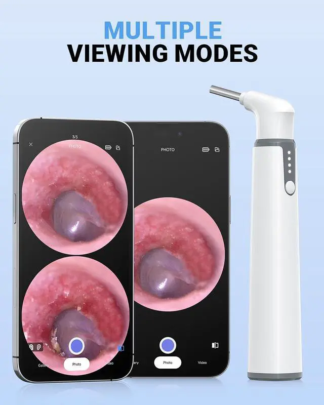Alt view image 7 of 7 - WiFi Otoscope, HD Otoscope Camera with Light, Ear Checker for Kids & Adults
