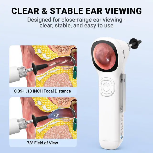 Alt view image 5 of 7 - Otoscope with Light, No App Needed, HD Screen, Ear Scope Camera for Family