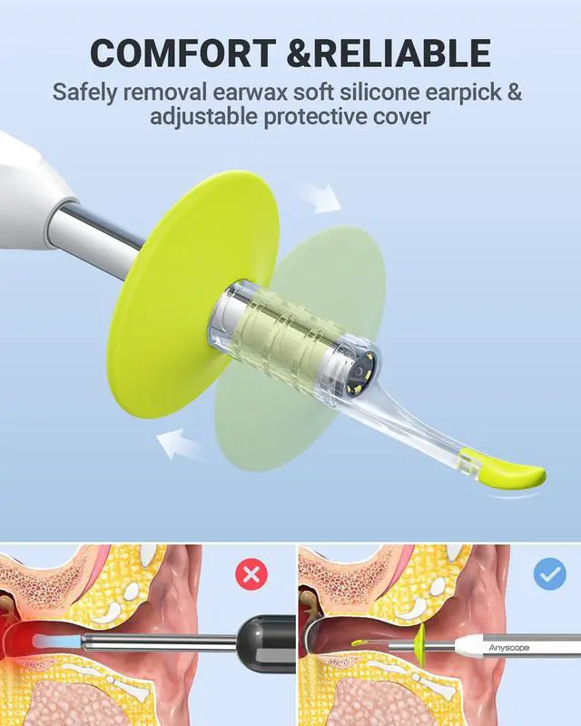 Alt view image 4 of 6 - Otoscope with Gyroscope, Ear Scope Camera, Compatible with iPhone/Android
