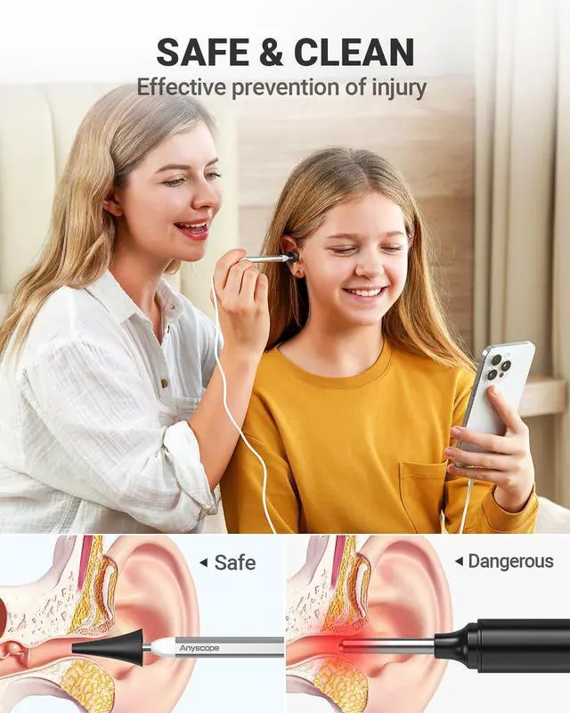 Alt view image 5 of 6 - Otoscope with Gyroscope, Ear Scope Camera, Compatible with iPhone/Android