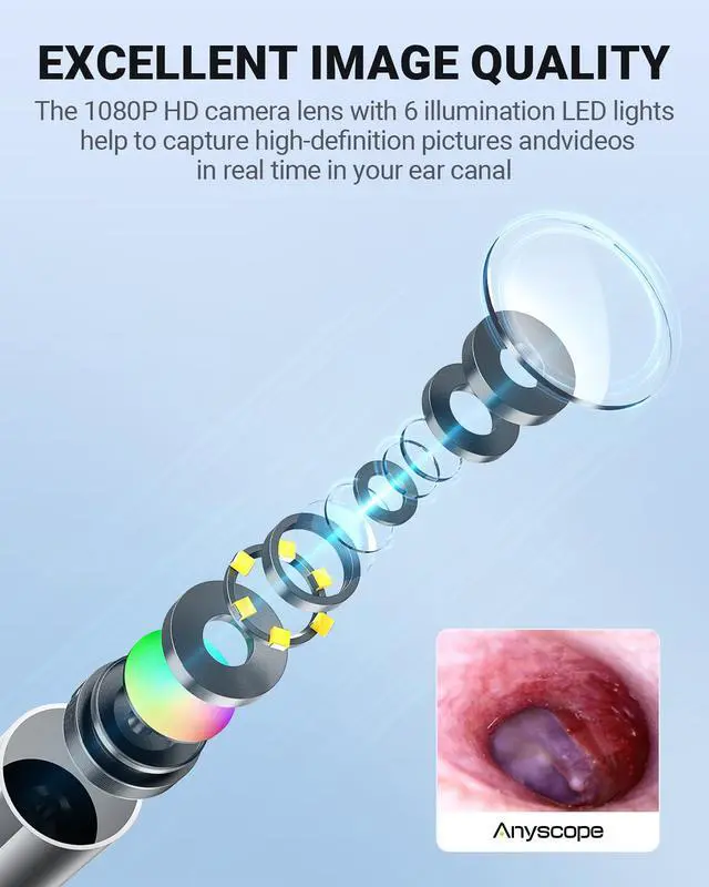Alt view image 6 of 6 - Otoscope with Gyroscope, Ear Scope Camera, Compatible with iPhone/Android