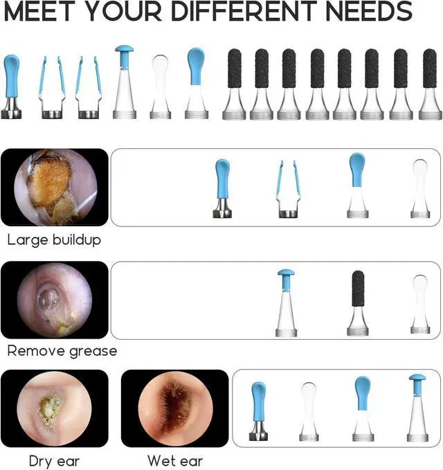Alt view image 6 of 7 - Original Ear Camera Replacement Tips, 14pcs Waterproof Silicone Ear Spoon Accessories Compatible with Bebird Earsight Plus R37R, D39R, B31R & R1 Ultra