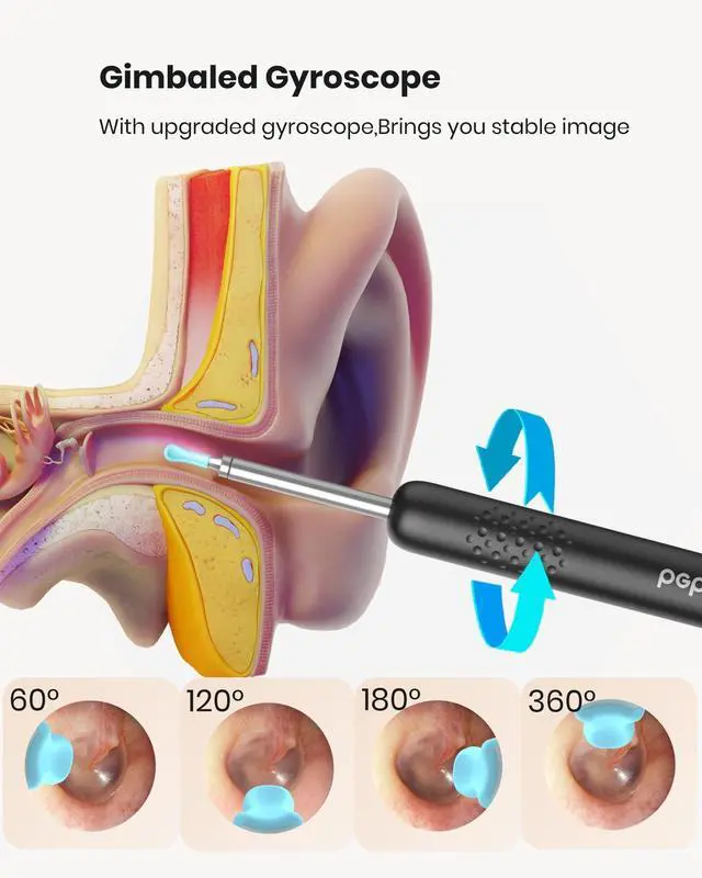 Alt view image 6 of 7 - R1 Ear Wax Removal Tool:Ear Cleaner with HD Ear Camera FSA, Black