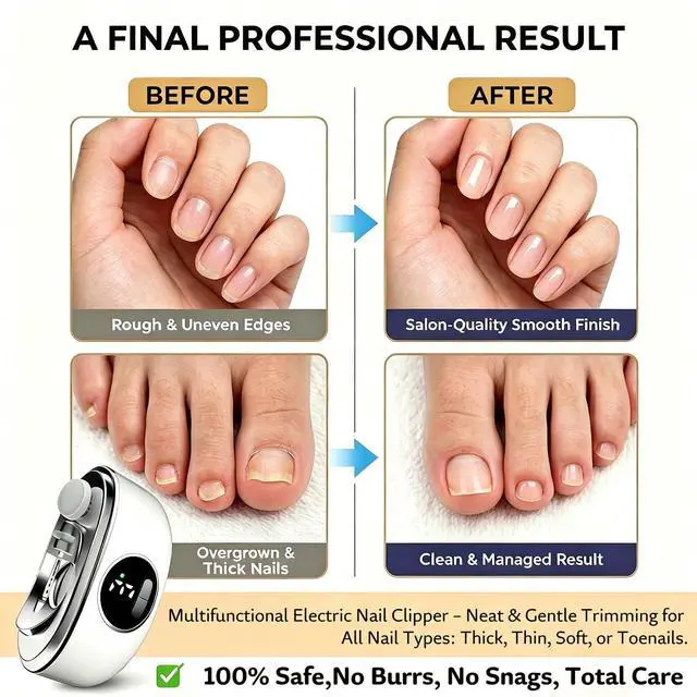 Alt view image 2 of 7 - Electric Nail Clipper for Seniors, Automatic Nail Trimmer