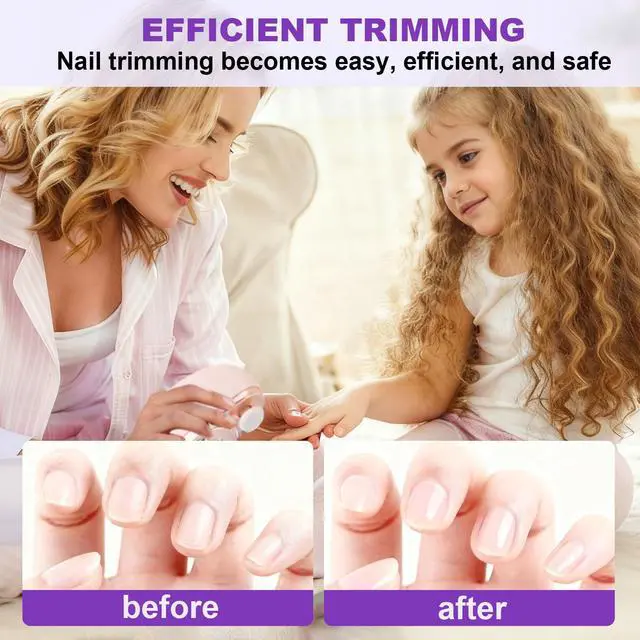 Alt view image 6 of 7 - Electric Nail Clipper for Seniors & Adults, 2 in 1 Baby Auto Nail Trimmer