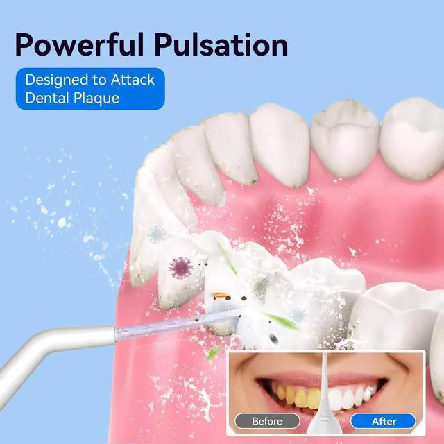 Alt view image 2 of 7 - Cordless Portable Water Flosser with 300ML Tank: Rechargeable Oral Irrigator with 5 Tips for Travel, Braces Care and Sensitive Gums, IPX7 Waterproof Teeth Cleaning Device(Blue