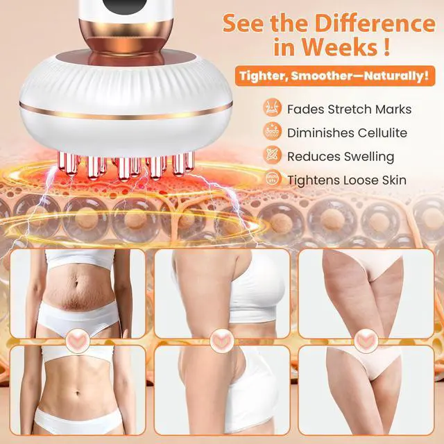 Alt view image 6 of 7 - 4-in-1 Lymphatic Drainage Massager Anti Cellulite Body Sculpting Device