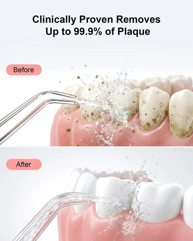 Alt view image 7 of 7 - Cordless Water Flosser - 6 Pressure Settings with 3 Modes, 220ml Compact Ergonomic Design, 30 Days Long Battery, IPX7 Waterproof Portable Oral Irrigator for Teeth, Gums & Braces (Pink)