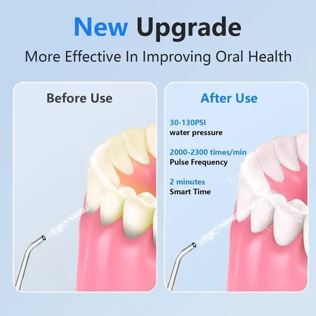 Alt view image 3 of 6 - Water Dental Flosser Cordless - Rechargeable IPX7 Waterproof Teeth Pick Flossing Cleaner,Portable 320ml Tank 6-Mode Oral Irrigator for Teeth/Braces/Tongue,Storage Box for Travel & Home