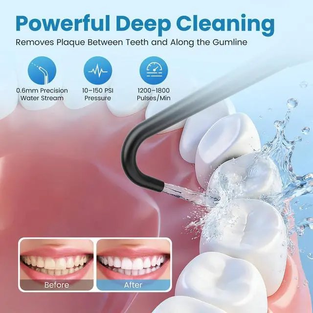 Alt view image 4 of 7 - Water Flosser for Teeth, Cordless Oral Irrigator with U-Shaped Tip, 12 Adjustable Levels, 300ML Rechargeable Portable Dental Flosser for Braces & Travel