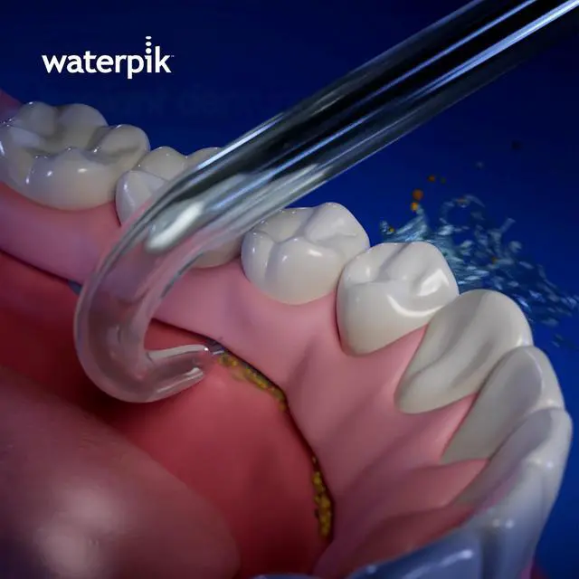 Alt view image 4 of 4 - Water Flosser Implant Denture Replacement Tips, 2 Count DT-100E