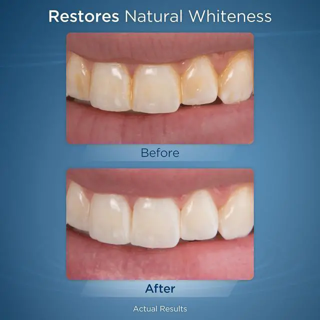 Alt view image 5 of 5 - Fresh Mint Whitening Refill Tablets (30 Count), Restore Natural Teeth Whiteness, Packaging May Vary, WT-30