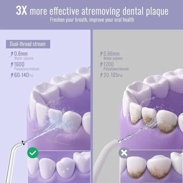 Alt view image 3 of 6 - Water Flossers for Teeth, Travel Portable Cordless Oral Irrigator Water flosser, Mini 4 Tips 3 Modes Teeth Cleaner, IPX7 Waterproof Water Floss for Brace Tooth, White