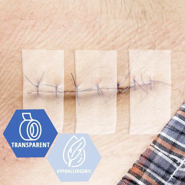 Alt view image 4 of 5 - Transparent Surgical Tape,1 in x 10 yd,Hypoallergenic,12-Pack