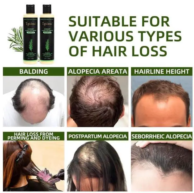 Alt view image 4 of 7 - Rosemary Biotin Volumizing Shampoo for Thinning Hair, 7.4 Fl Oz