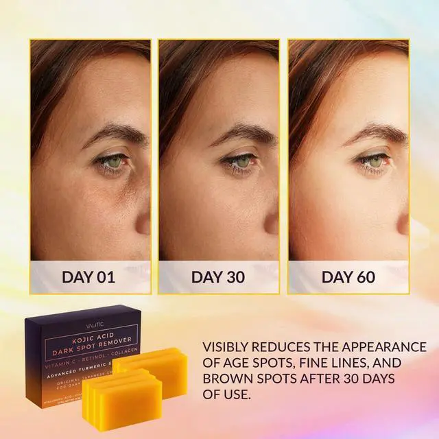 Alt view image 2 of 6 - Kojic Acid Dark Spot Remover Soap Bars with Vitamin C, Retinol, Collagen, Turmeric - Original Japanese Complex Infused with Hyaluronic Acid, Vitamin E, Shea Butter, Castile Olive Oil - 5 Pack