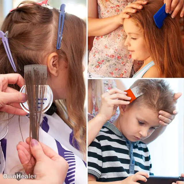 Alt view image 5 of 6 - Professional Lice Comb Kit - for Lice, Nits, and Dandruff Removal. Quick Results for Head Lice Treatment - Suitable for All Hair Types. Peine para piojos y liendres.