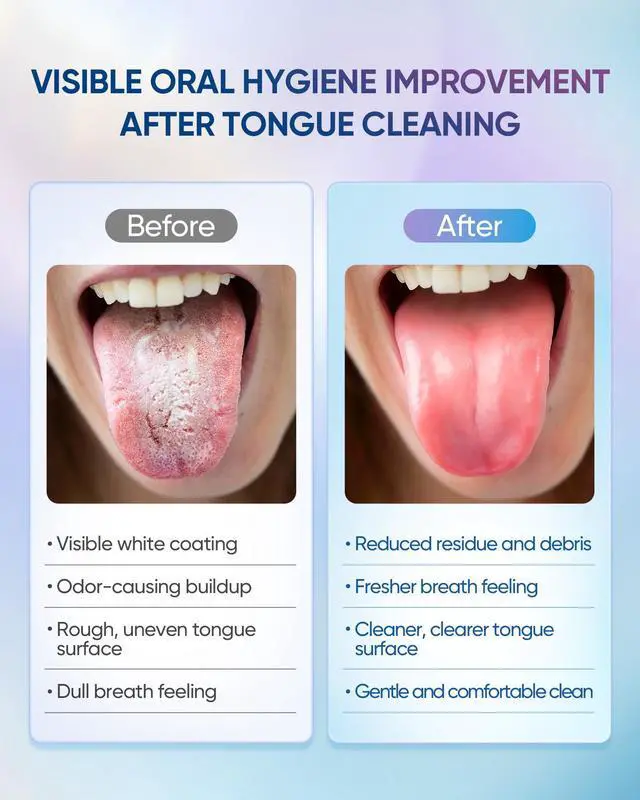 Alt view image 4 of 7 - Tongue Cleaner Gel with Tongue Brush Fresh Breath Oral Care Kit Tongue Scraper Gel Set for Bad Breath Removal, Maintain Oral Health