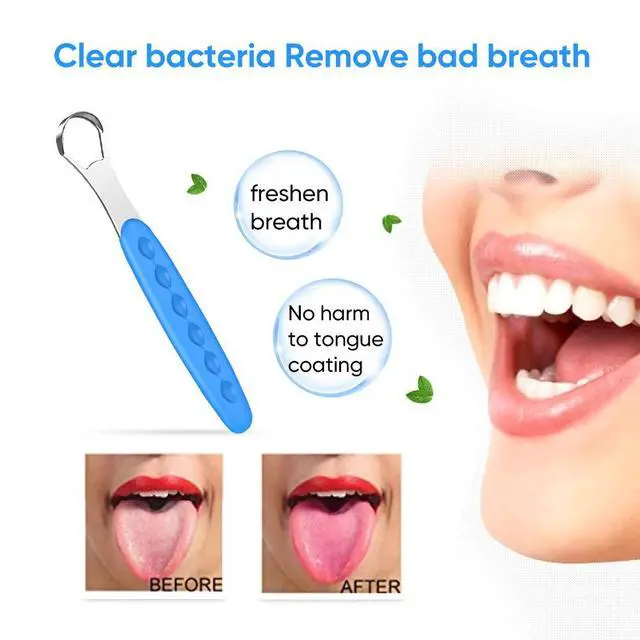 Alt view image 4 of 7 - New Version Tongue Scraper Cleaner for Adults & Kids, Medical Grade Metal Tongue Brushes Set for Fresh Breath Dental Eliminate Bad Breath in Seconds