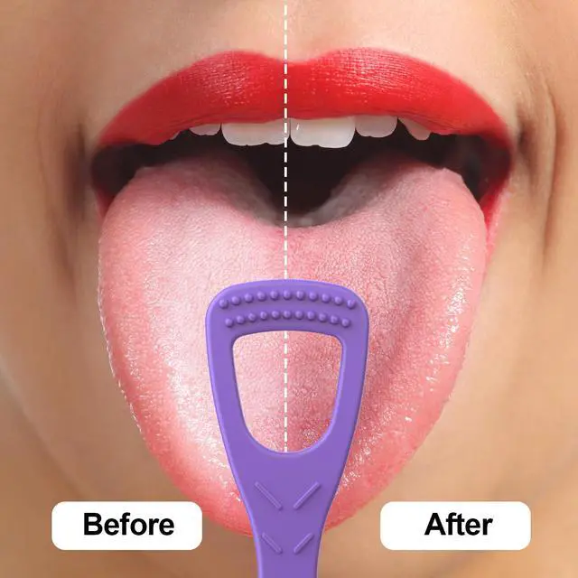 Alt view image 5 of 7 - Disposable Tongue Cleaners, Dual-Sided, Fresh Breath, 100ct